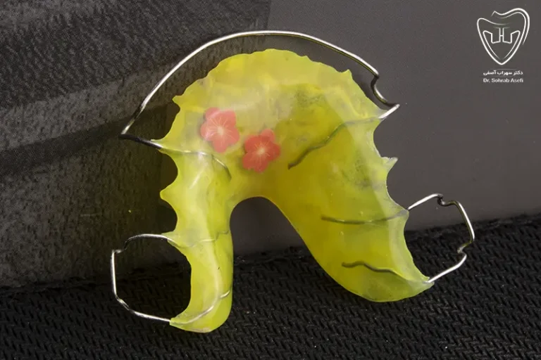 ارتودنسی متحرک