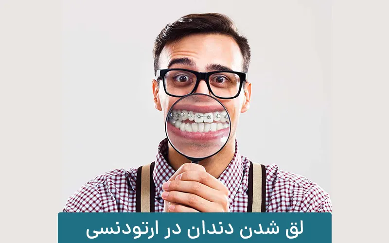 لق شدن دندان در ارتودنسی واقعیت دارد؟