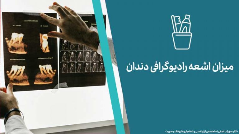 میزان اشعه رادیوگرافی دندان