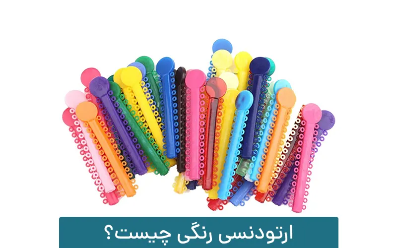 ارتودنسی رنگی چیست؟
