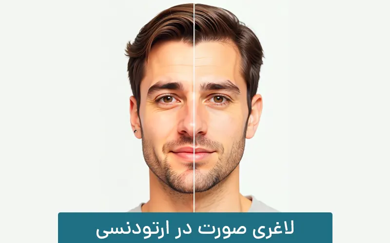 تاثیر ارتودنسی بر لاغری صورت