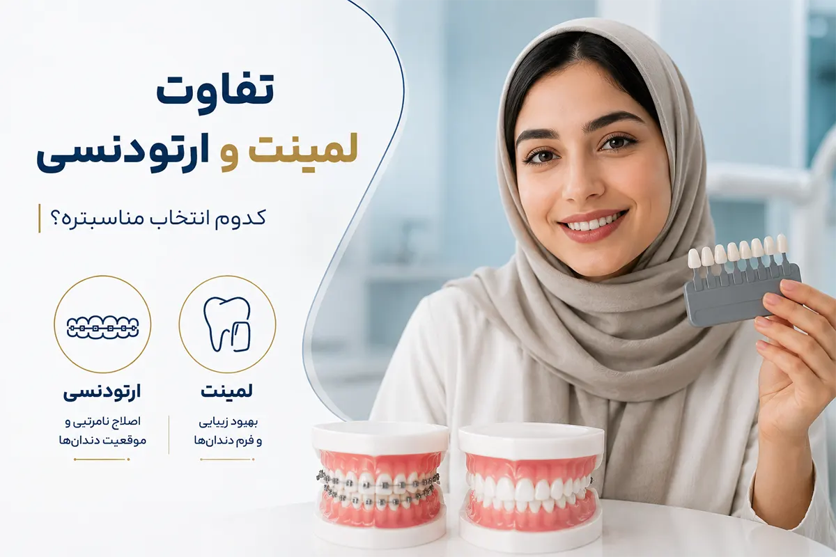 ارتودنسی یا لمینت، کدام را انتخاب کنم؟