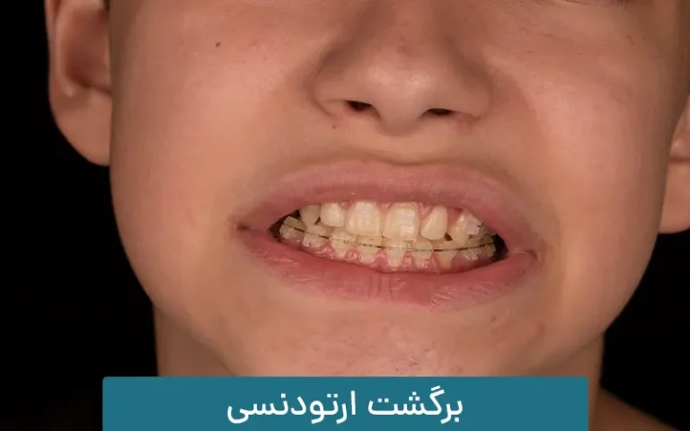 برگشت ارتودنسی